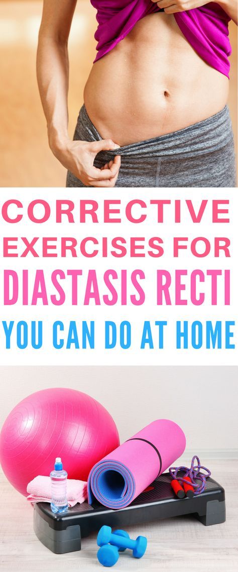 Diastasis Recti Exercises - Diastasis recti or separated abdominal muscles can t...